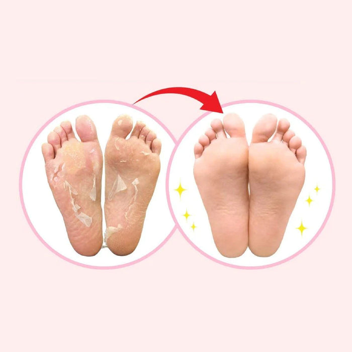 SOSU Perorin Foot Peeling Pack Lavender 27cm 2pairs
