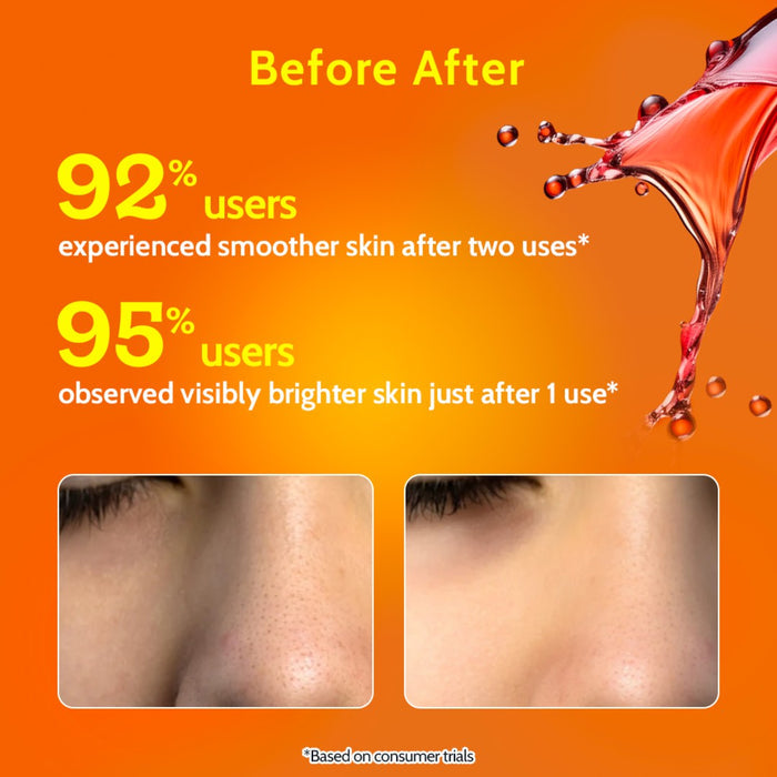 26% AHA + 4% PHA + 2% BHA Exfoliating Peeling Solution for Tan Removal & Pigmentation - 30 ml