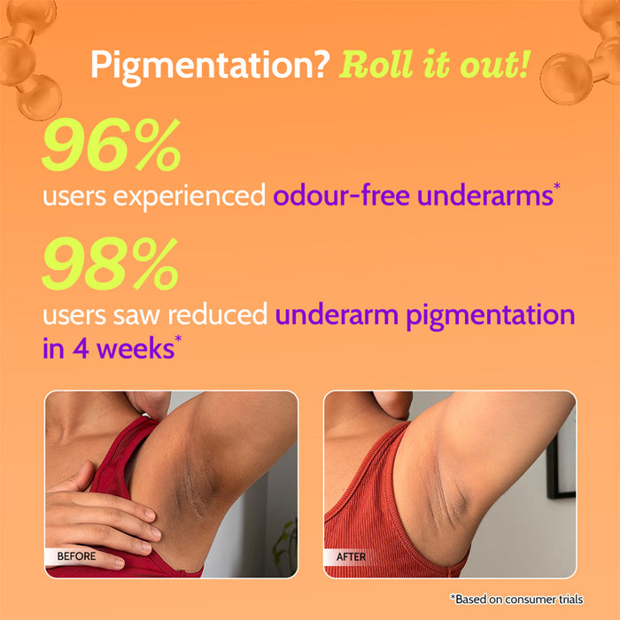 5% AHA Underarm Roll On for Odour Control & Pigmentation (Aqua) - 75 ml