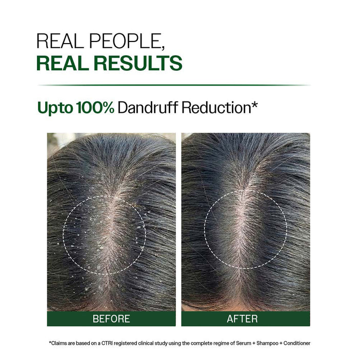 Anti Dandruff Shampoo With Salicylic Acid, Piroctone Olamine & Biotin - 250 ml