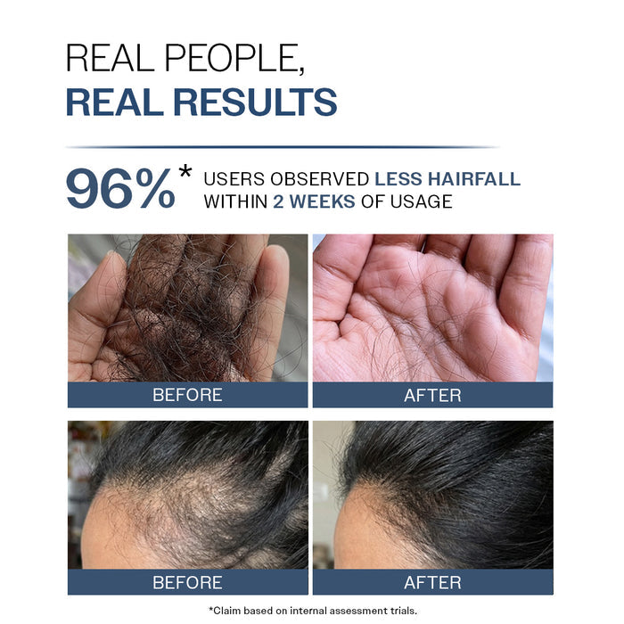 Anti-Hair Fall Shampoo With Adenosine & Peptides for Hair Fall Control - 250 ml