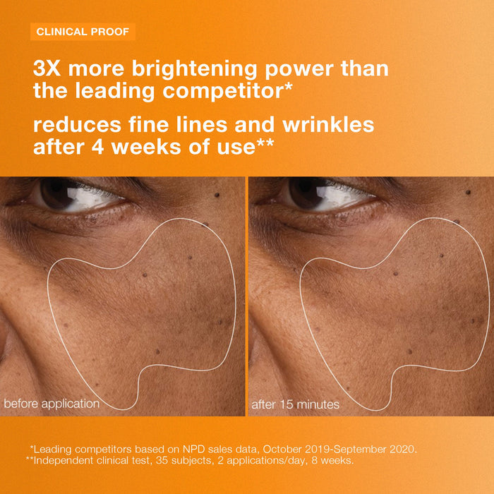 biolumin-c vitamin c gel moisturizer clinical