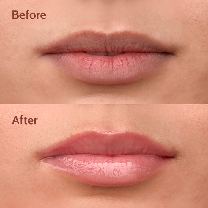 Ceramides + 2% Kojic Acid Tinted Lip Balm (Vanilla) | SPF 50 PA++++ | 10 gm