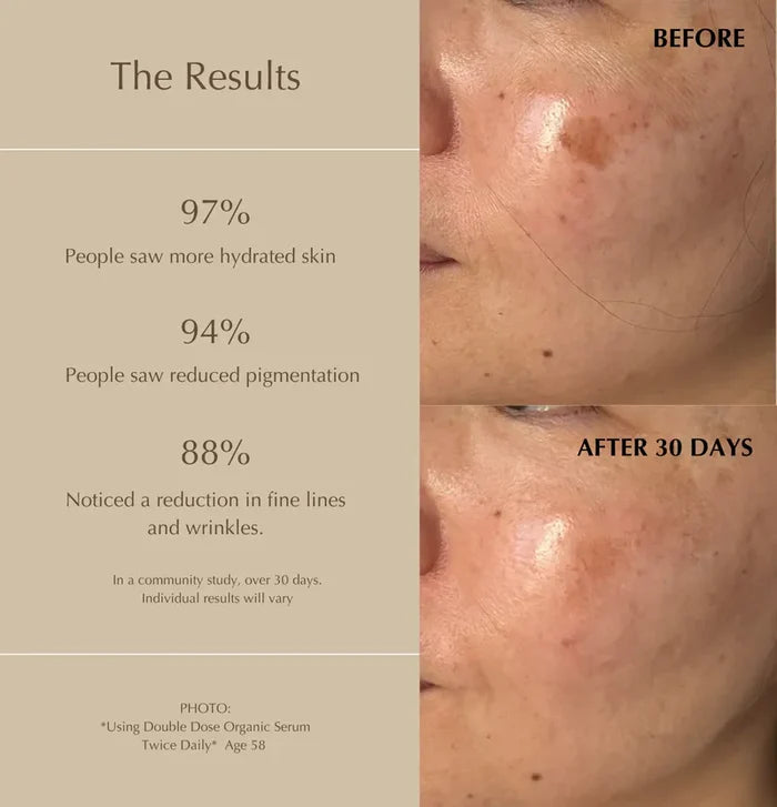 DR ALTHEA Gentle vitamin C 20% serum سيروم الفيتامين سي من دكتور الثيا