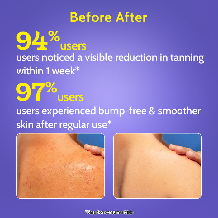 Exfoliating Body Wash with 1% Lactic Acid & 2% Salicylic Acid - 473 ml