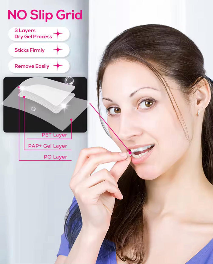 GlorySmile teeth whitening strips