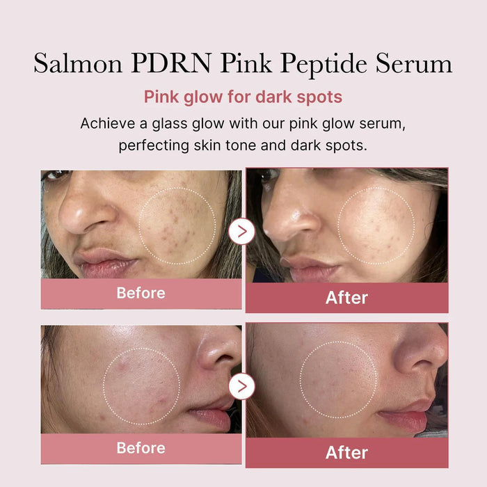 Medicube PDRN Pink Peptide Serum 30 mL