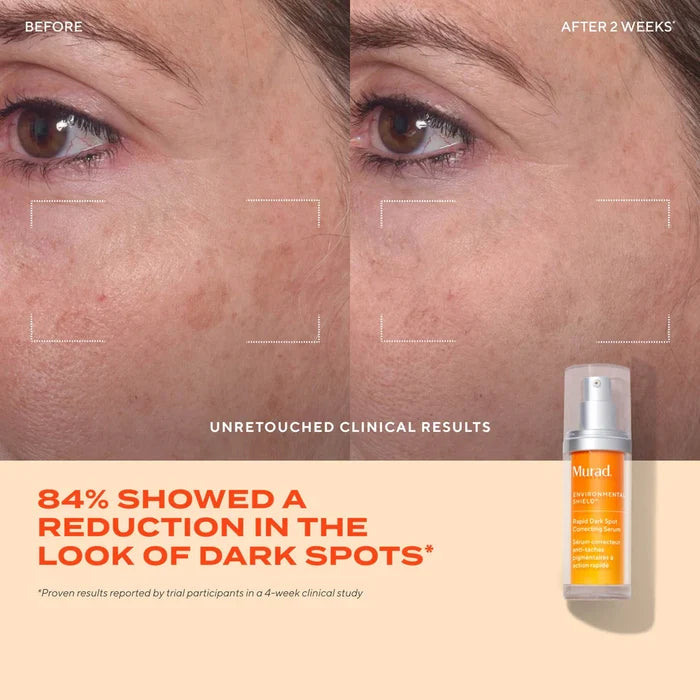 Murad Rapid Dark Spot Correcting Serum