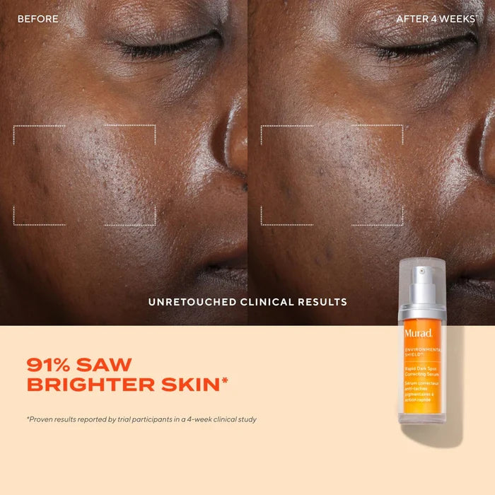 Murad Rapid Dark Spot Correcting Serum