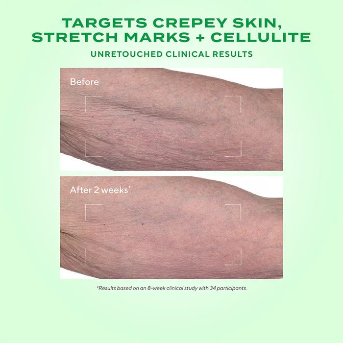 Murad Retinal ReSculpt Body Treatment