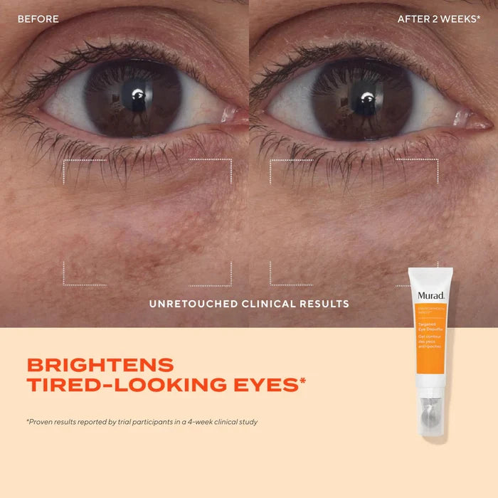 Murad Targeted Eye Depuffer