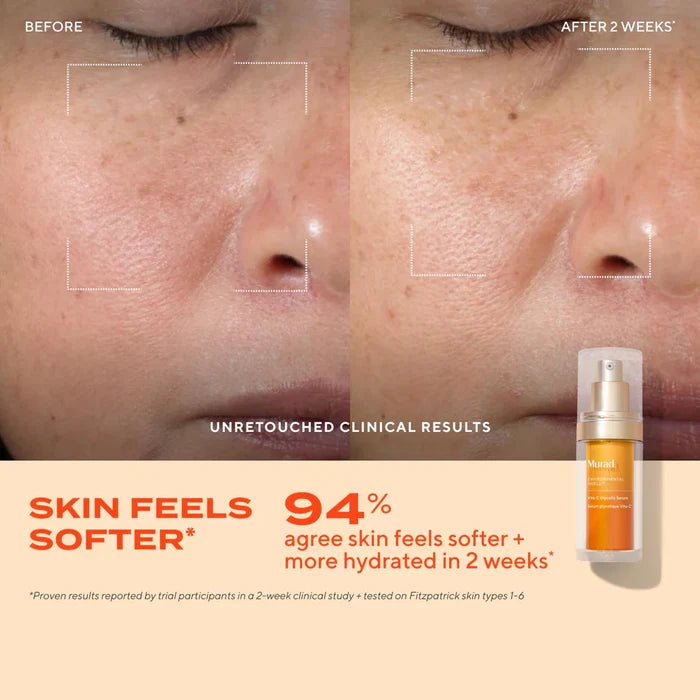 Murad Vita-C Glycolic Serum