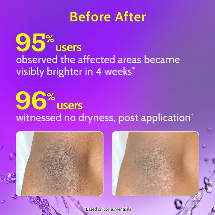 Neck, Knee & Elbow Brightening Roll On With Mandelic Acid & Niacinamide - 40 ml