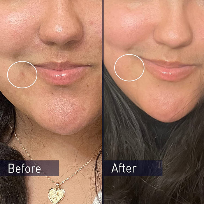 PANOXYL Acne Foaming Wash 10% Benzoyl Peroxide Maximum Strength غسول البشرة