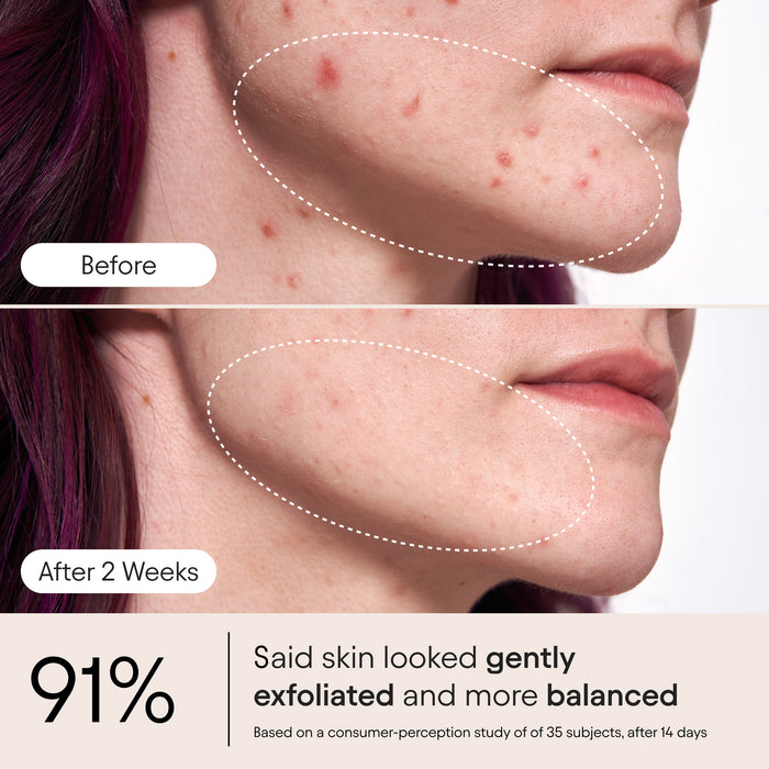 Alpyn Beauty-Pore Perfecting Liquid with 2% BHA + Borage-Skincare-PorePerfectingLiquid3-The Detox Market |