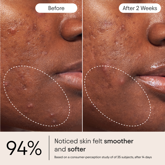 Alpyn Beauty-Pore Perfecting Liquid with 2% BHA + Borage-Skincare-PorePerfectingLiquid4-The Detox Market |