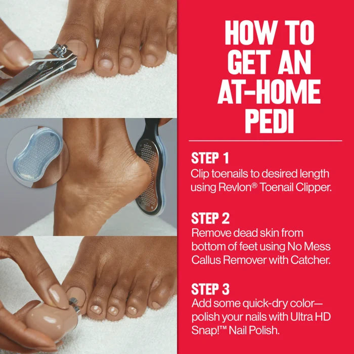REVLON Callus Remover With Catcher اداة العناية بالقدم من ريفلون