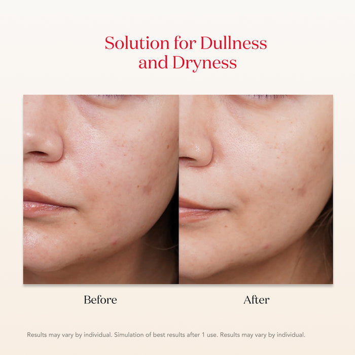 SK-II PITERA™ Facial Treatment Mask