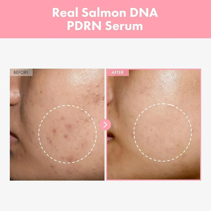[TOSOWOONG] Pink Peptide 12 PDRN Serum 33ml - Ballagrio