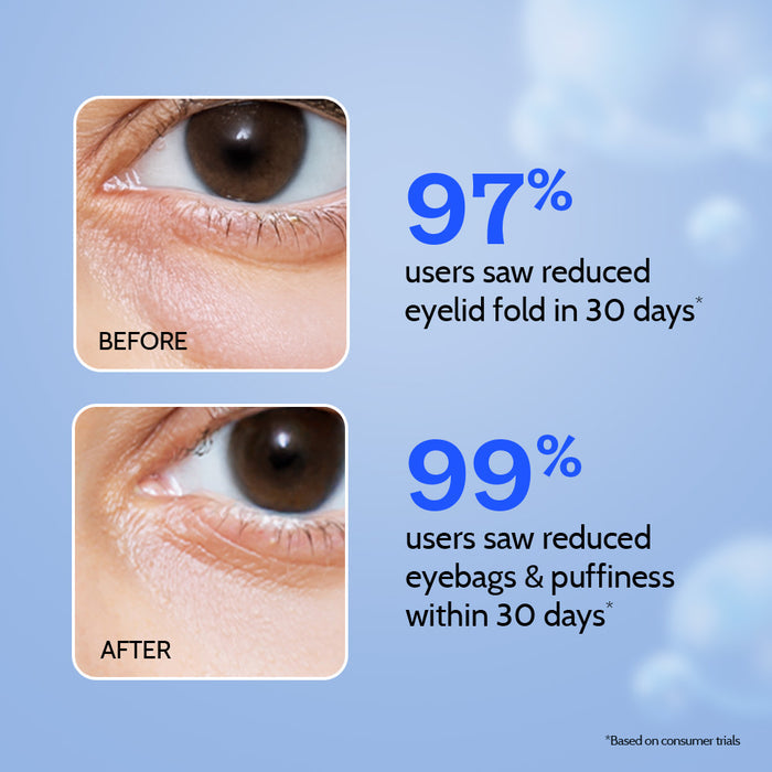 Under Eye Cream for Dark Circles with Caffeine & Green Tea - 15 gm